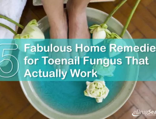 5 Fabulous Home Remedies for Toenail Fungus That Actually Work