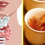 Drink This Delicious Homemade Tea as a Natural Treatment for Hyperthyroidism