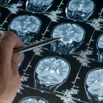 Neuroscientist Explains What Fasting Does To Your Brain & Why Big Pharma Won’t Study It