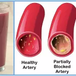 How to Make Pomegranate Juice — To Help Unclog Arteries & Prevent Heart Disease
